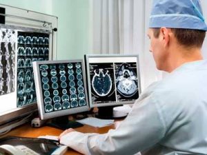 What causes Epilepsy?