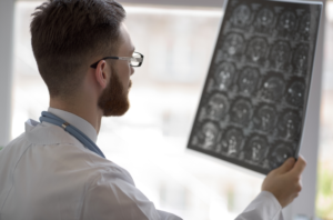 What is a seizure?